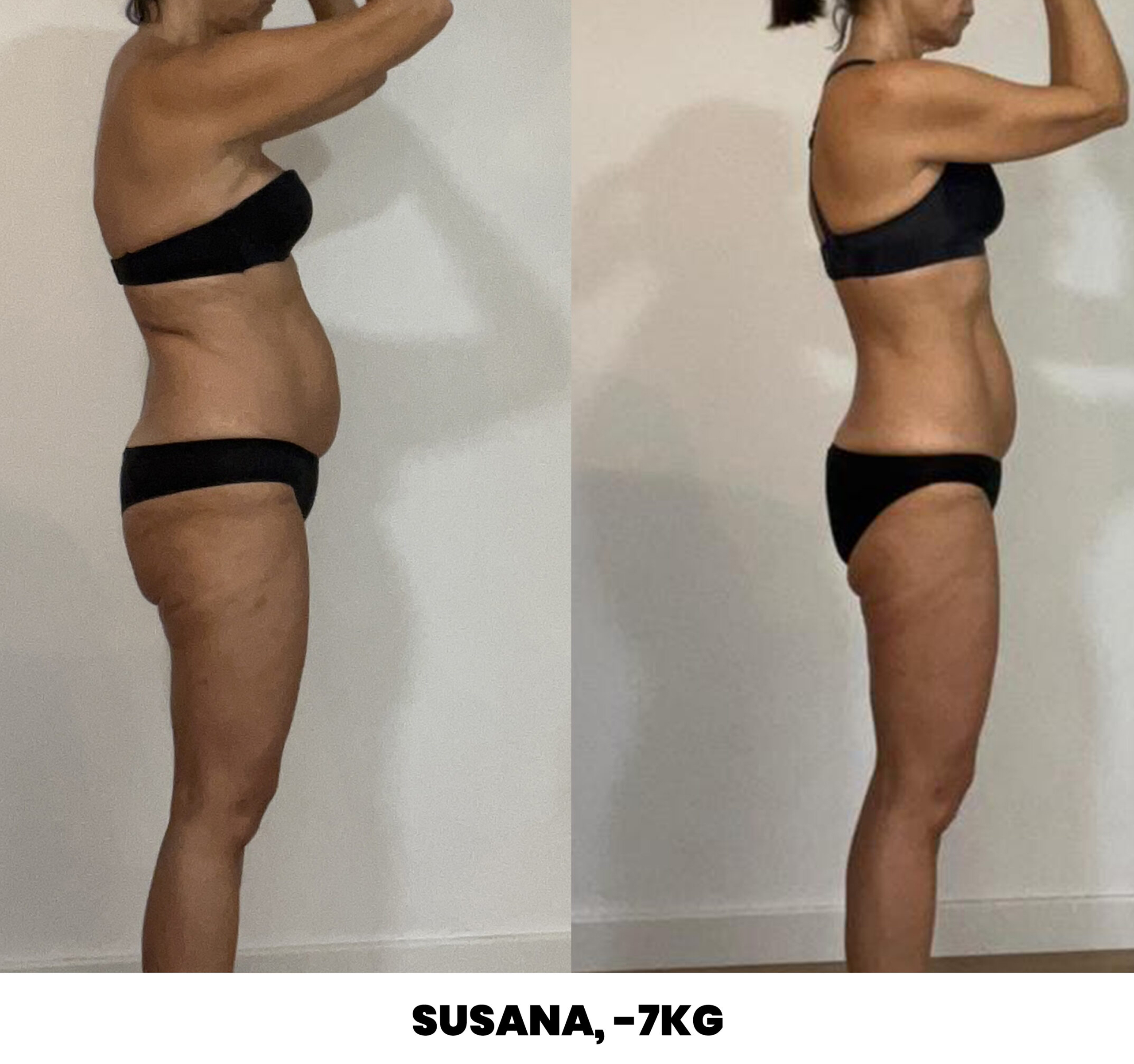 lateral-susana-scaled